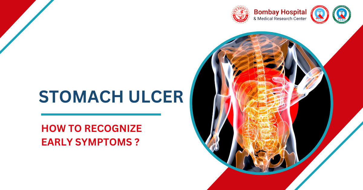 How to Recognize the Early Symptoms of a Stomach Ulcer